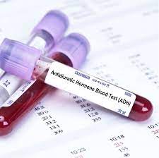 adh testi antidiüretik hormon hakkında bilgi veriyor