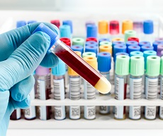 kan testi kan tahlili hakkıda bilgi veriyor