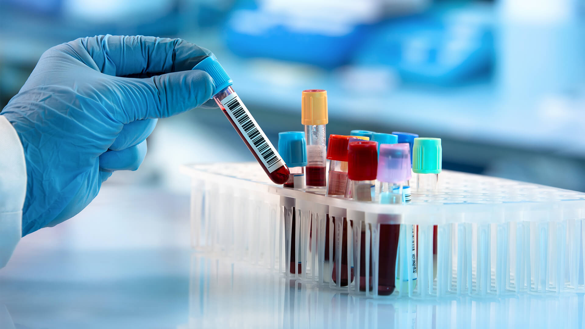 Hastalıkları Önlemek İçin En İyi 10 Kan Testi
