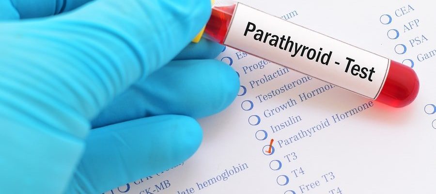 paratiroid hormon testi nedir