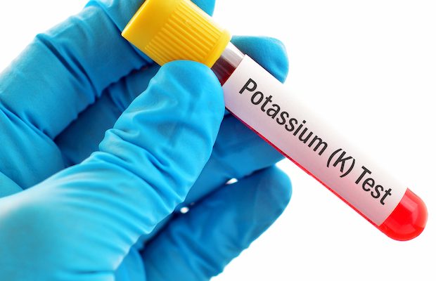 potasyum kan testi fiyatları