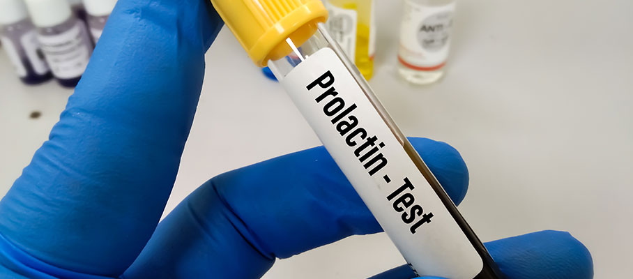 prolaktin testi
