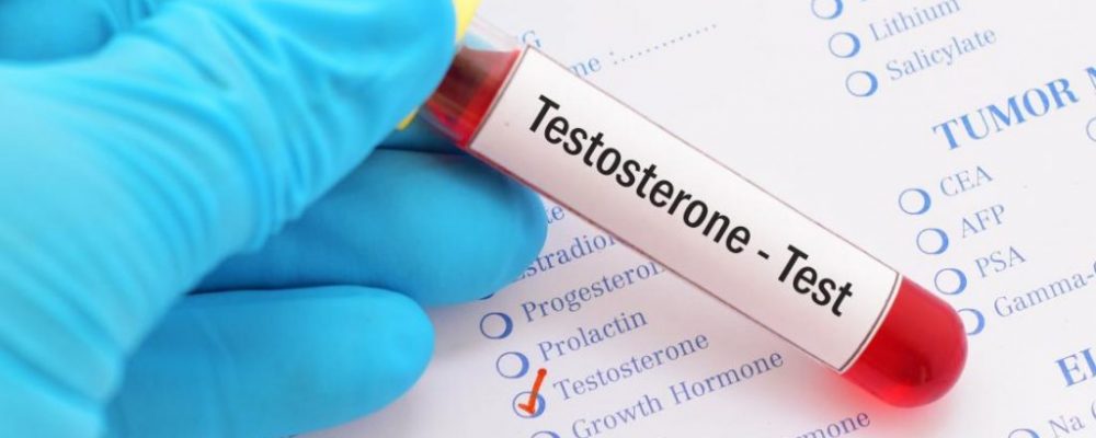 testosteron testi fiyatları