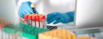 Alfa-1-antitripsin-testi