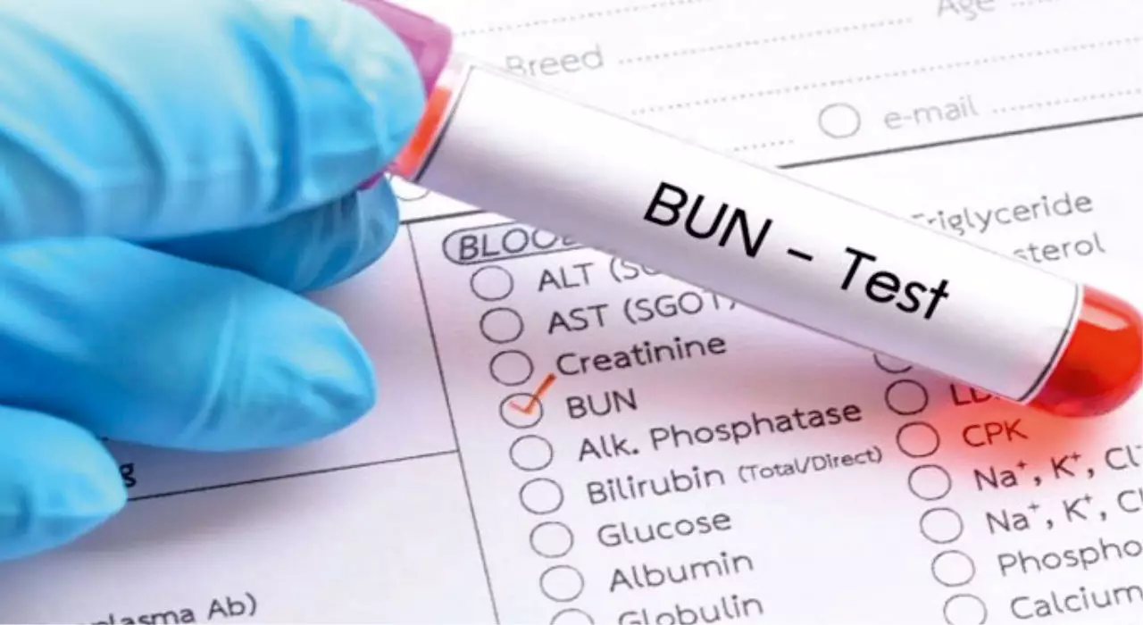BUN-Kan-Testi-Bobrek-Sagliginizi-Anlamak-Icin-Kritik-Bir-Inceleme (1)