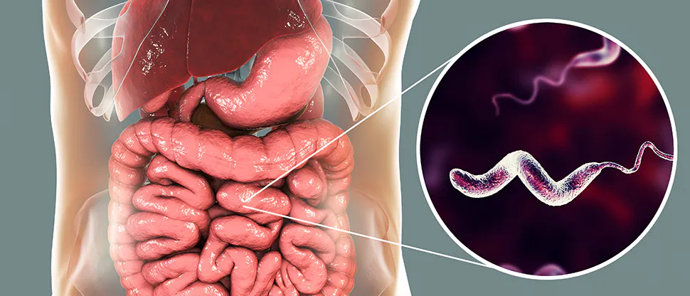 Campylobacter-Seroloji-Testi-Tani-ve-Tedavi-Surecleri