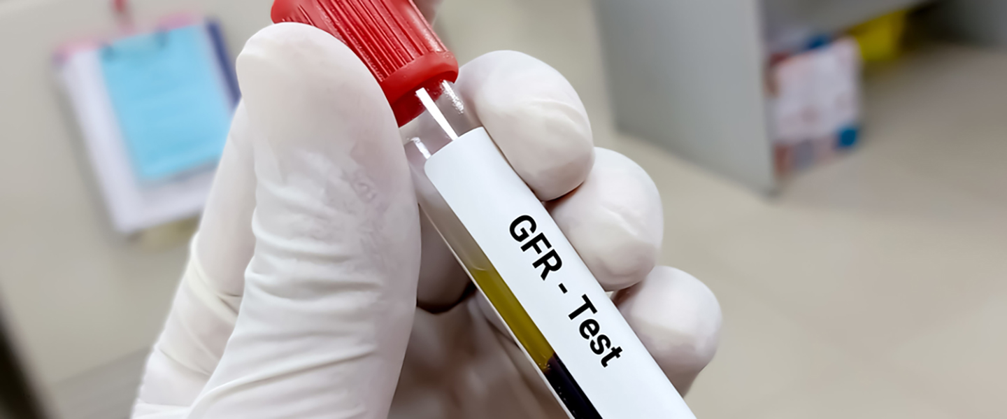 Glomeruler-Filtrasyon-Bobrek-Sagliginin-Onemli-Bir-Gostergesi