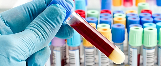 biotin-testi-fiyatlari-2022