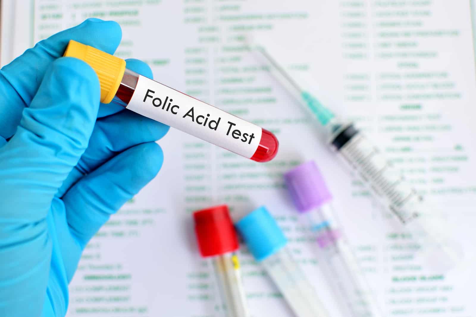 folik-asit-testi-fiyatlari