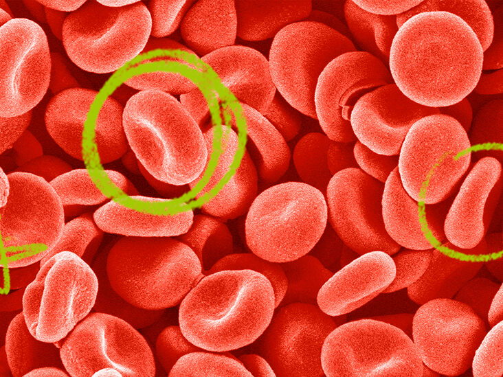 hemoglobin-nedir