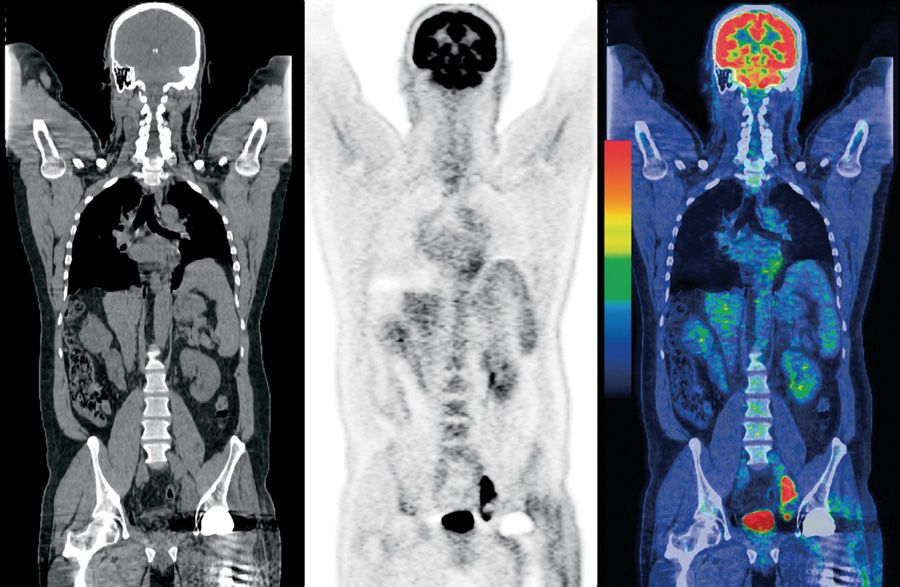 pet-CT-taramasi