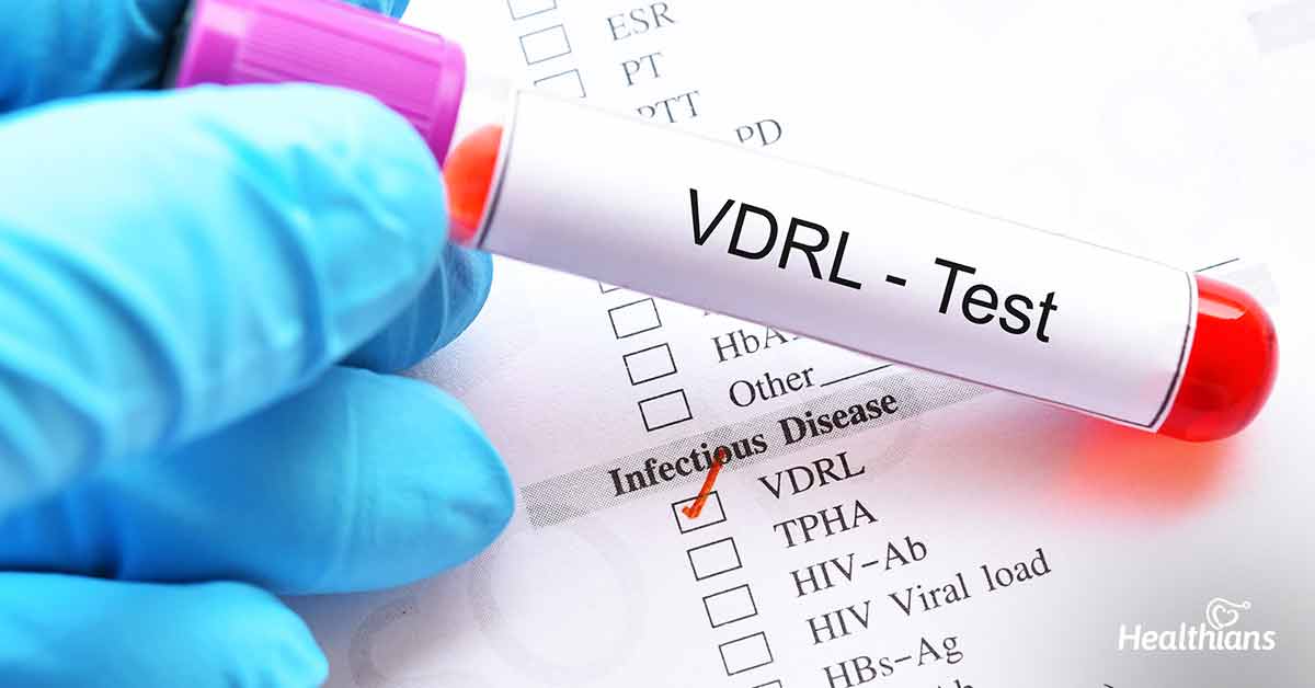 vdrl-testi-fiyatlari