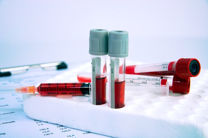 quantiferon testi nedir